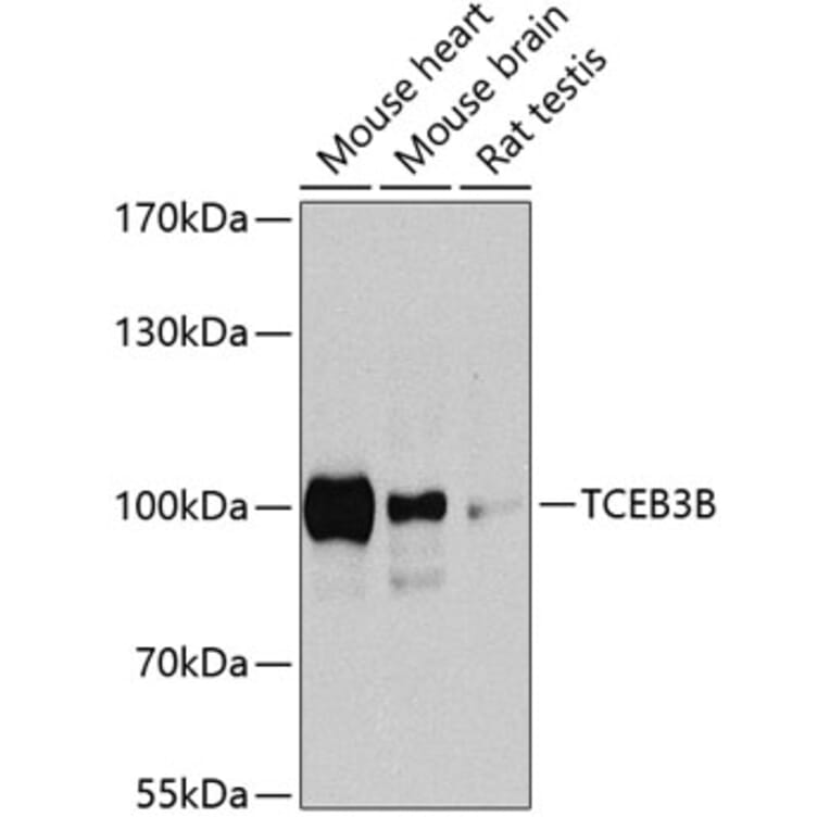 Western Blot - Anti-TCEB3B Antibody (A17242) - Antibodies.com
