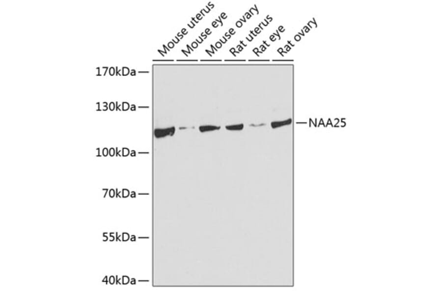 Western Blot - Anti-NAP1 (C12orf30)/p120 Antibody (A17243) - Antibodies.com