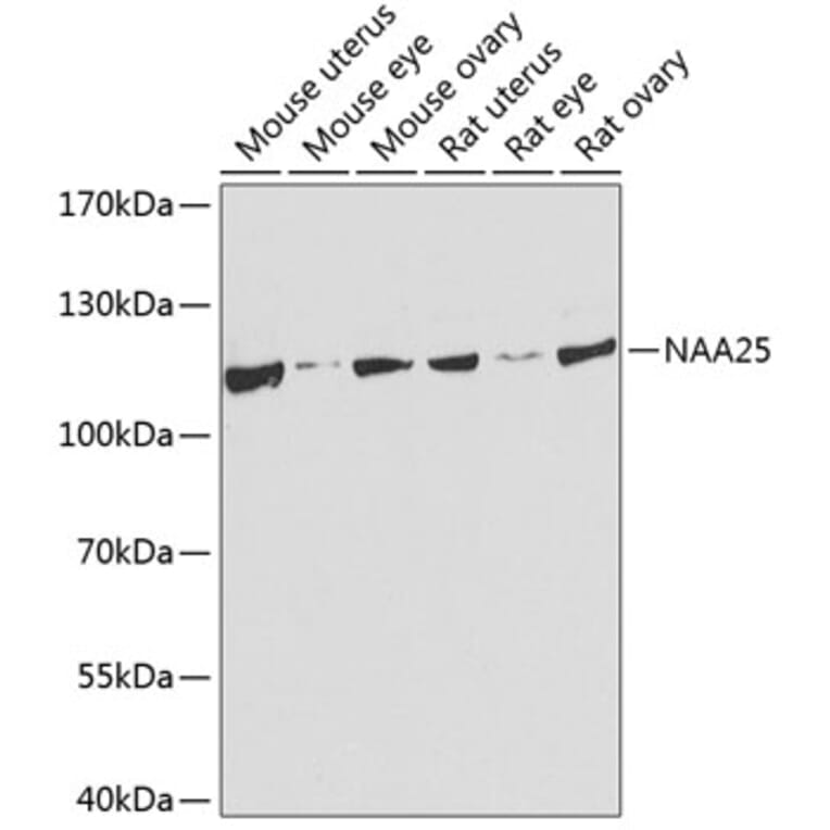 Western Blot - Anti-NAP1 (C12orf30)/p120 Antibody (A17243) - Antibodies.com