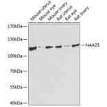 Western Blot - Anti-NAP1 (C12orf30)/p120 Antibody (A17243) - Antibodies.com