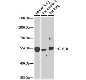 Western Blot - Anti-GLP-1R Antibody (A17244) - Antibodies.com