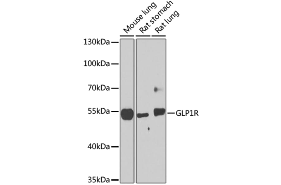 Western Blot - Anti-GLP-1R Antibody (A17244) - Antibodies.com