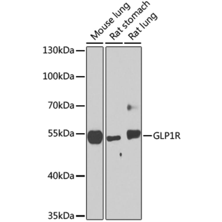 Western Blot - Anti-GLP-1R Antibody (A17244) - Antibodies.com