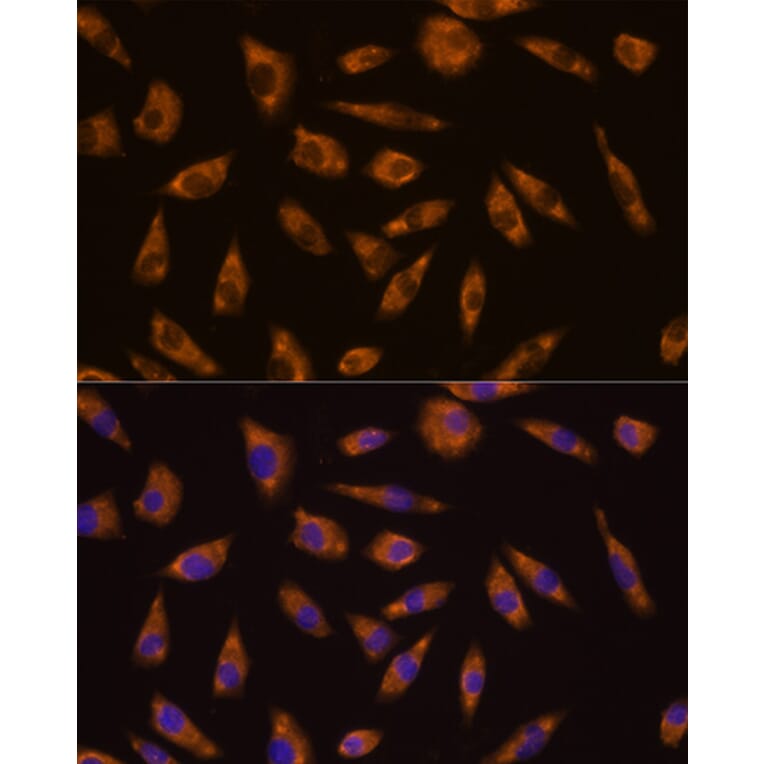 Immunofluorescence - Anti-GLP-1R Antibody (A17244) - Antibodies.com