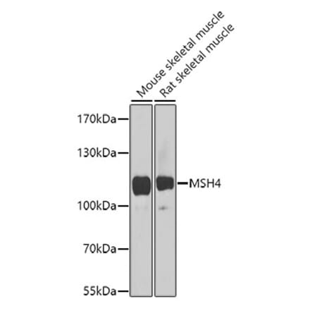 Western Blot - Anti-MSH4 Antibody (A17246) - Antibodies.com