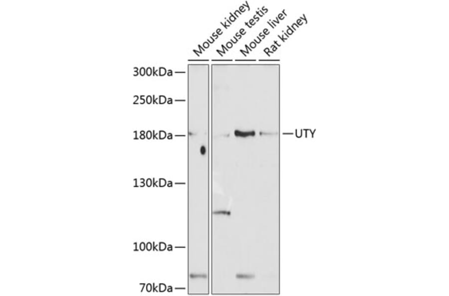 Western Blot - Anti-UTY Antibody (A17247) - Antibodies.com