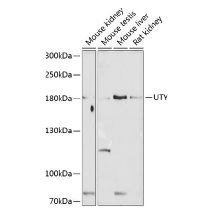 Western Blot - Anti-UTY Antibody (A17247) - Antibodies.com