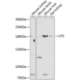 Western Blot - Anti-UTY Antibody (A17247) - Antibodies.com