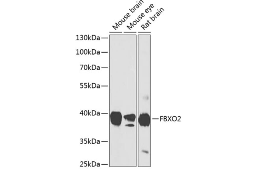 Western Blot - Anti-FBXO2 Antibody (A17248) - Antibodies.com