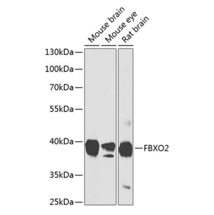 Western Blot - Anti-FBXO2 Antibody (A17248) - Antibodies.com