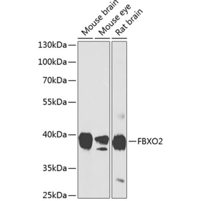 Western Blot - Anti-FBXO2 Antibody (A17248) - Antibodies.com