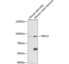 Western Blot - Anti-TRPV3 Antibody (A17249) - Antibodies.com