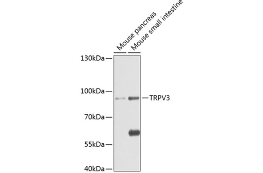 Western Blot - Anti-TRPV3 Antibody (A17249) - Antibodies.com