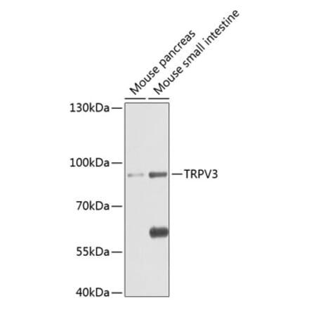 Western Blot - Anti-TRPV3 Antibody (A17249) - Antibodies.com