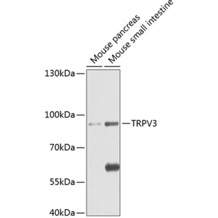 Western Blot - Anti-TRPV3 Antibody (A17249) - Antibodies.com