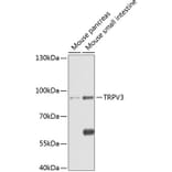 Western Blot - Anti-TRPV3 Antibody (A17249) - Antibodies.com