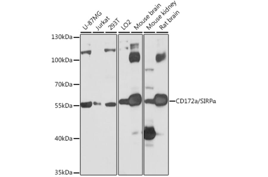 Western Blot - Anti-SIRP alpha Antibody (A17252) - Antibodies.com