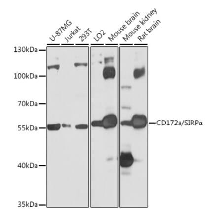 Western Blot - Anti-SIRP alpha Antibody (A17252) - Antibodies.com
