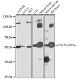 Western Blot - Anti-SIRP alpha Antibody (A17252) - Antibodies.com