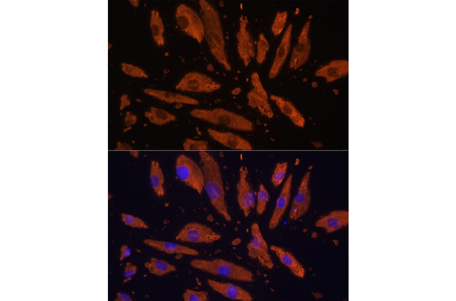 Immunofluorescence - Anti-SIRP alpha Antibody (A17252) - Antibodies.com