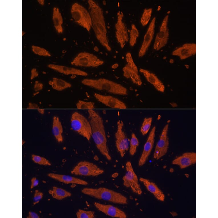 Immunofluorescence - Anti-SIRP alpha Antibody (A17252) - Antibodies.com