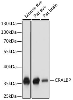 Western blot analysis of extracts of various cell lines, using Anti-RLBP1 Antibody (A9094) at 1:1,000 dilution.
Secondary antibody: Goat Anti-Rabbit IgG (H+L) (HRP) (AS014) at 1:10,000 dilution.
Lysates / proteins: 25µg per lane.
Blocking buffer: 3% non-fat dry milk in TBST.
Detection: ECL Basic Kit (RM00020).
Exposure time: 1s.