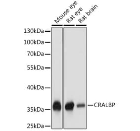 Western Blot - Anti-CRALBP Antibody (A17253) - Antibodies.com