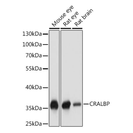 Western Blot - Anti-CRALBP Antibody (A17253) - Antibodies.com