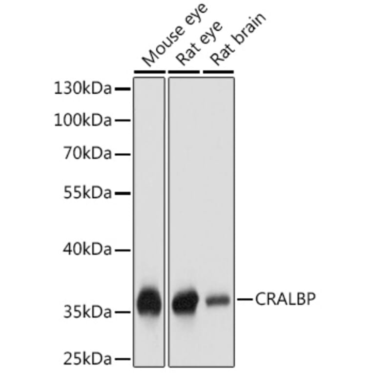 Western Blot - Anti-CRALBP Antibody (A17253) - Antibodies.com