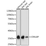 Western Blot - Anti-CRALBP Antibody (A17253) - Antibodies.com