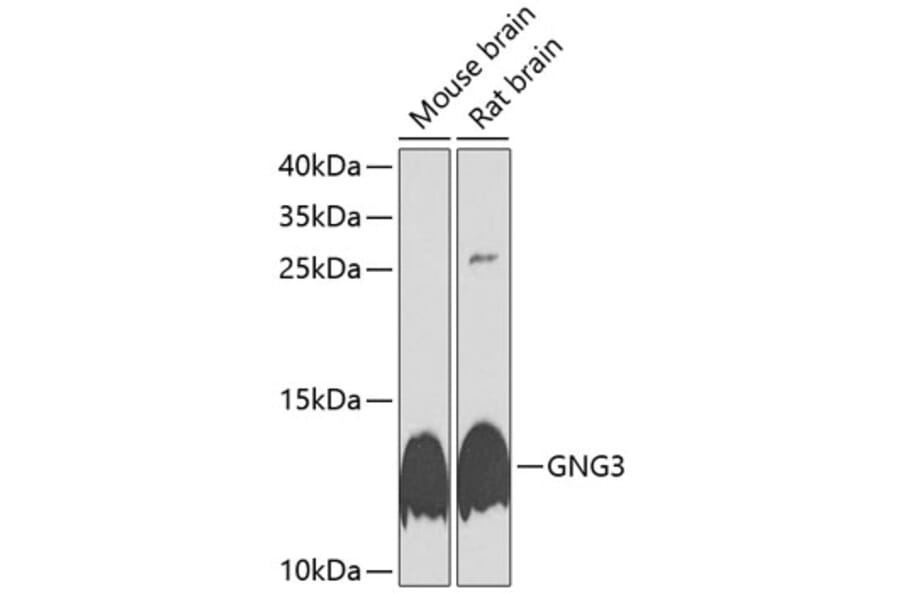 Western Blot - Anti-GNG3 Antibody (A17255) - Antibodies.com