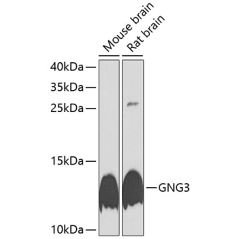 Western Blot - Anti-GNG3 Antibody (A17255) - Antibodies.com