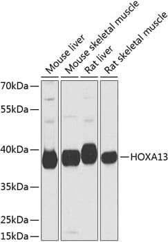 Western blot analysis of extracts of various cell lines, using Anti-HOXA13 Antibody (A9822) at 1:1,000 dilution.
Secondary antibody: Goat Anti-Rabbit IgG (H+L) (HRP) (AS014) at 1:10,000 dilution.
Lysates / proteins: 25µg per lane.
Blocking buffer: 3% non-fat dry milk in TBST.
Detection: ECL Basic Kit (RM00020).
Exposure time: 10s.
