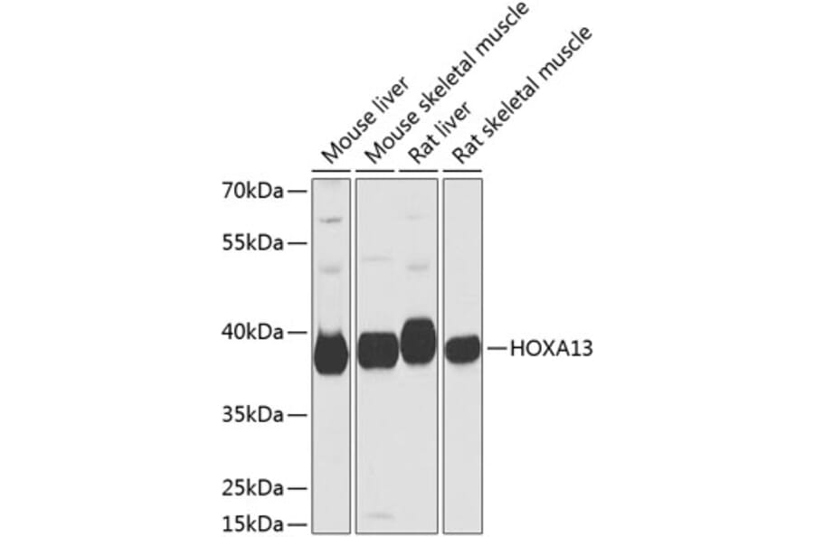 Western Blot - Anti-HOXA13 Antibody (A17256) - Antibodies.com