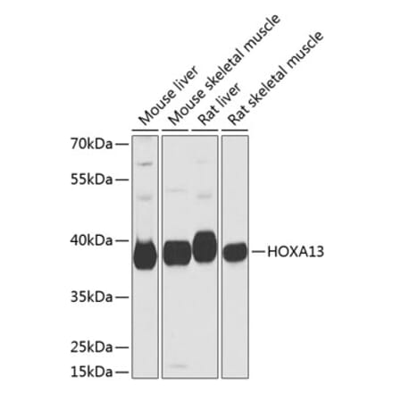 Western Blot - Anti-HOXA13 Antibody (A17256) - Antibodies.com