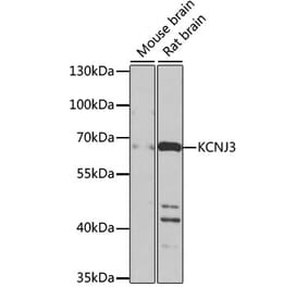 Western Blot - Anti-GIRK1 Antibody (A17257) - Antibodies.com