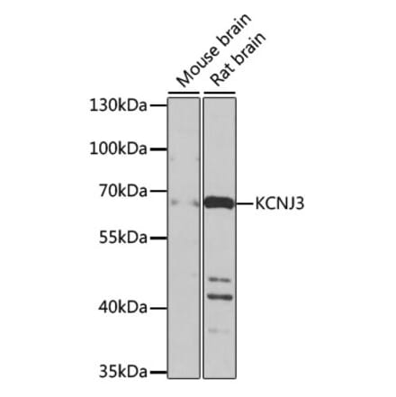 Western Blot - Anti-GIRK1 Antibody (A17257) - Antibodies.com