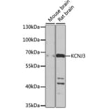 Western Blot - Anti-GIRK1 Antibody (A17257) - Antibodies.com