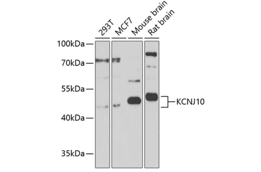 Western Blot - Anti-Kir4.1/KCNJ10 Antibody (A17259) - Antibodies.com