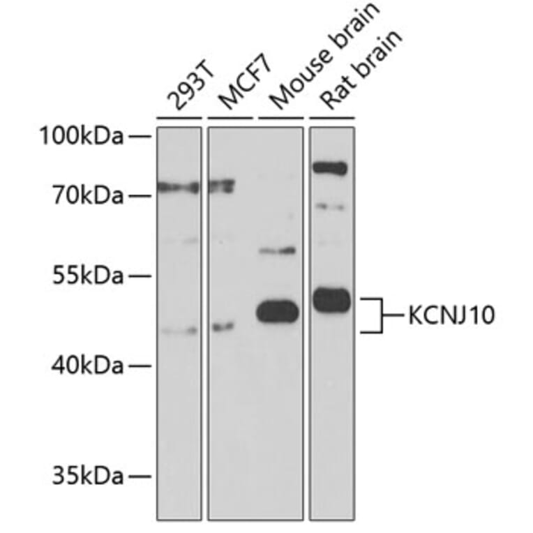Western Blot - Anti-Kir4.1/KCNJ10 Antibody (A17259) - Antibodies.com