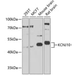 Western Blot - Anti-Kir4.1/KCNJ10 Antibody (A17259) - Antibodies.com