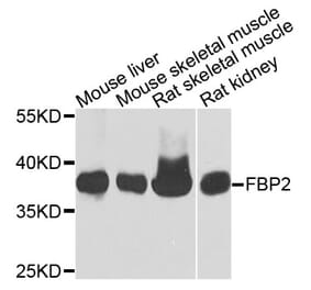 Western Blot - Anti-FBP2 Antibody (A9850) - Antibodies.com