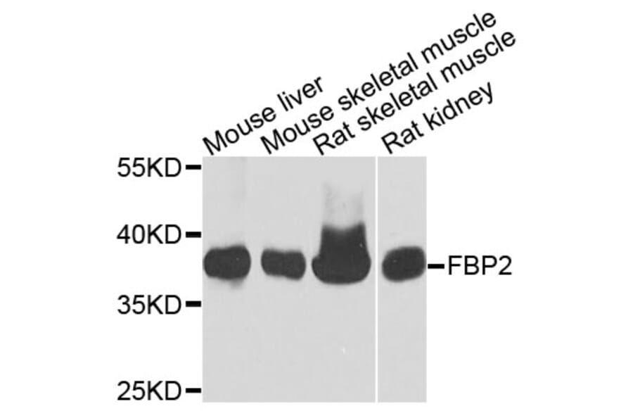 Western Blot - Anti-FBP2 Antibody (A9850) - Antibodies.com