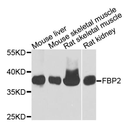 Western Blot - Anti-FBP2 Antibody (A9850) - Antibodies.com