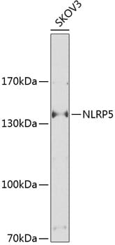 Western blot analysis of extracts of SKOV3 cells, using Anti-NLRP5 Antibody (A9886) at 1:1,000 dilution.
Secondary antibody: Goat Anti-Rabbit IgG (H+L) (HRP) (AS014) at 1:10,000 dilution.
Lysates / proteins: 25µg per lane.
Blocking buffer: 3% non-fat dry milk in TBST.
Detection: ECL Basic Kit (RM00020).
Exposure time: 20S.