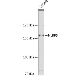 Western Blot - Anti-NALP5 Antibody (A17261) - Antibodies.com