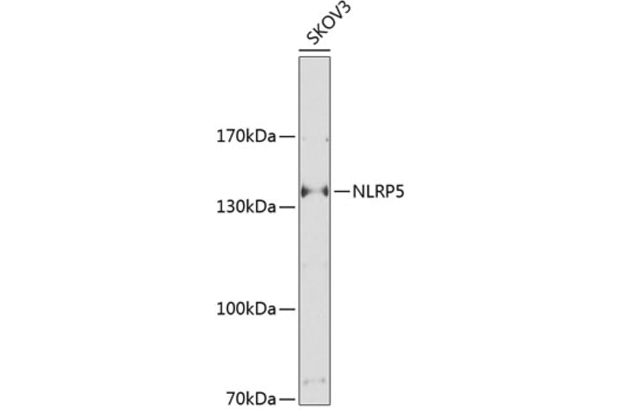 Western Blot - Anti-NALP5 Antibody (A17261) - Antibodies.com