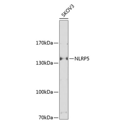 Western Blot - Anti-NALP5 Antibody (A17261) - Antibodies.com