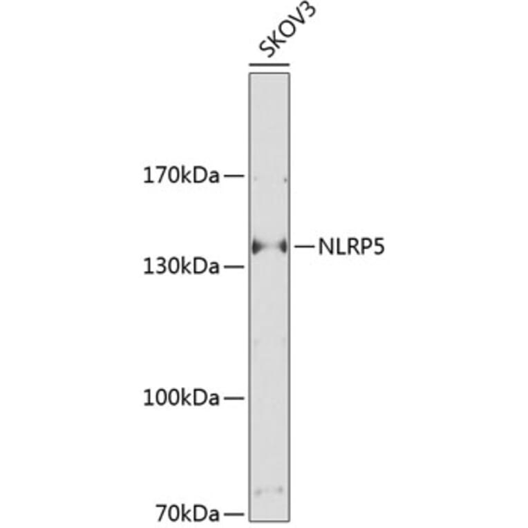 Western Blot - Anti-NALP5 Antibody (A17261) - Antibodies.com