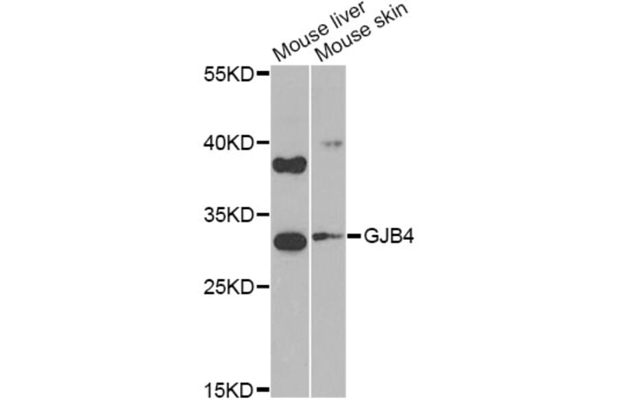 Western Blot - Anti-GJB4 Antibody (A9888) - Antibodies.com
